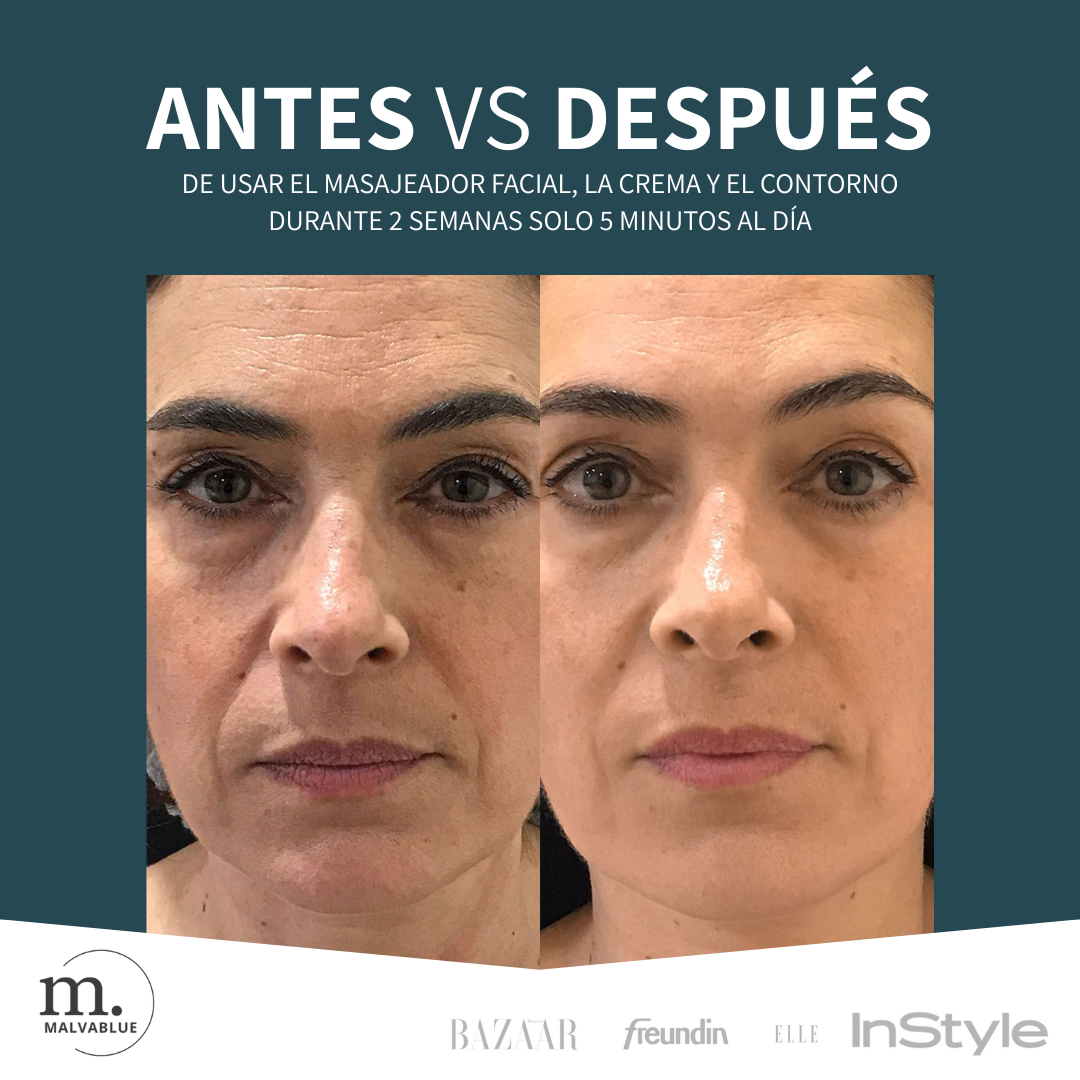 🔥 OFERTA EXCLUSIVA 24h: Masajeador Facial con Vibración + Crema Antiedad + Contorno Ojeras SAKURA
